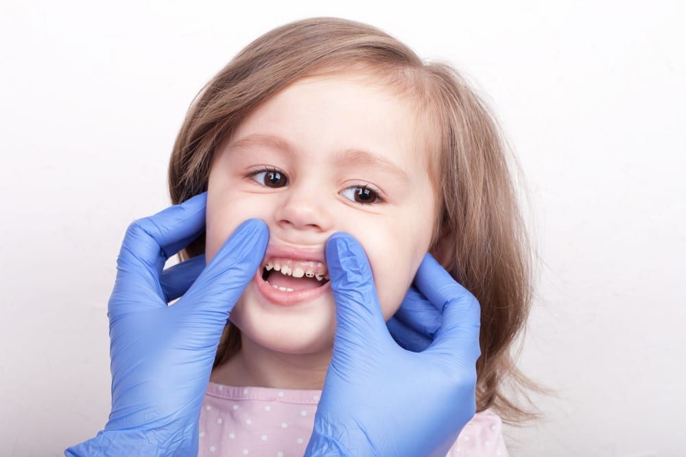 gum-disease-in-children-kids-world-pediatric-dentistry