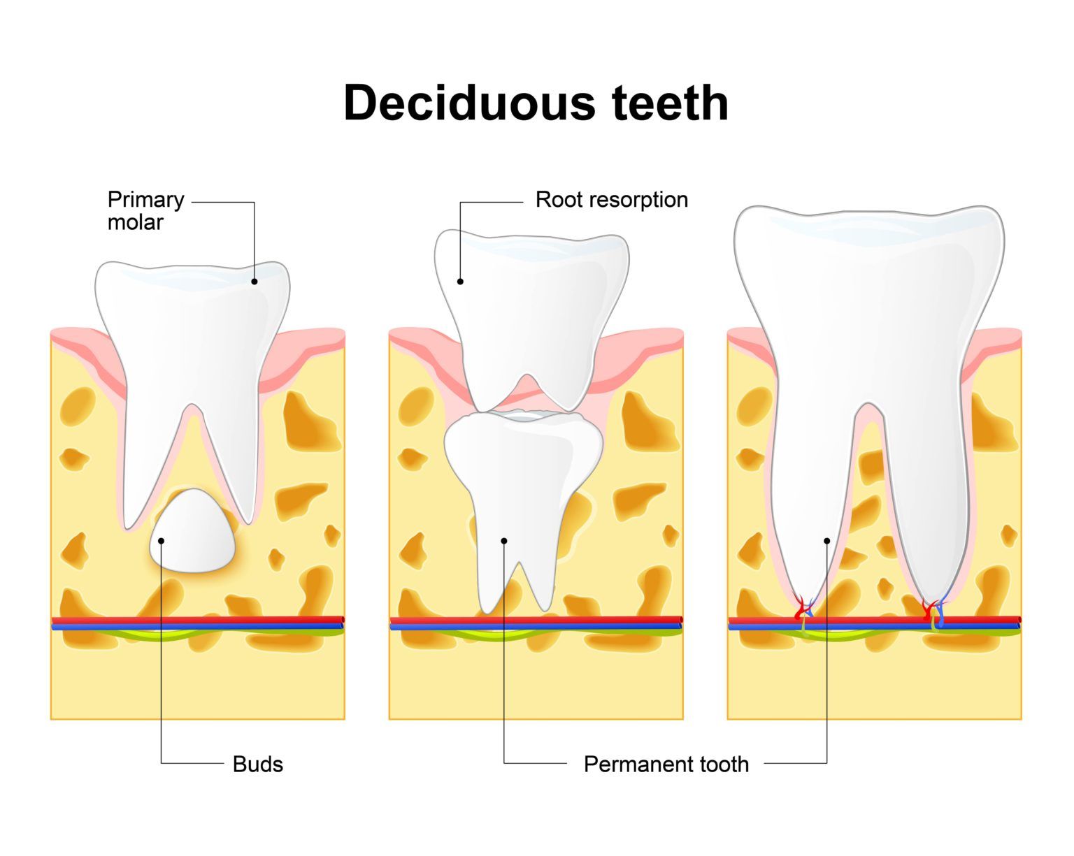 Подсыпание кости переднего зуба процесс