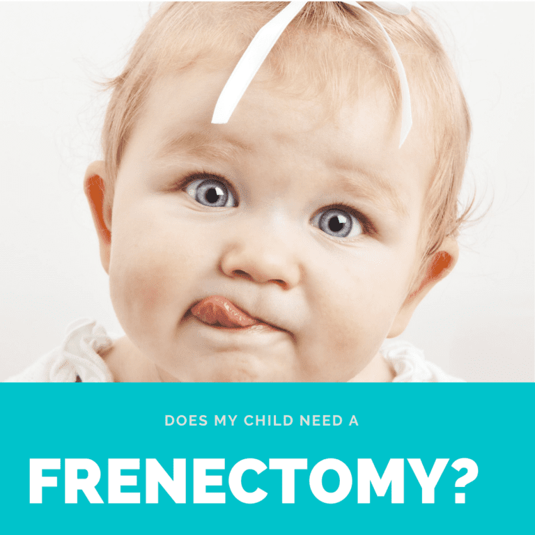 Does my child need a frenectomy (1)