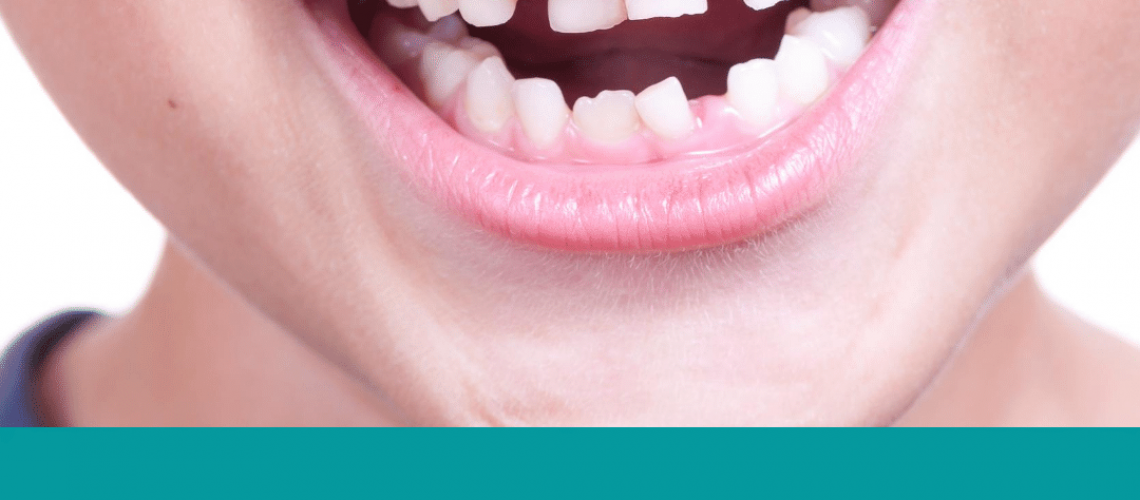 5 Things You Should Know About Baby Teeth